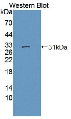 Invitrogen DATF1 Polyclonal Antibody 200 &mu;L; Unconjugated:Antibodies,