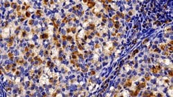 Invitrogen TRAIL-R2 (DR5) Polyclonal Antibody 200 &mu;L; Unconjugated:Antibodies,