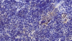 Invitrogen TRAIL-R2 (DR5) Polyclonal Antibody 200 &mu;L; Unconjugated:Antibodies,
