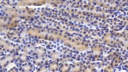 Invitrogen TRAIL-R2 (DR5) Polyclonal Antibody 200 &mu;L; Unconjugated:Antibodies,