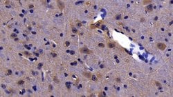 Invitrogen TRAIL-R2 (DR5) Polyclonal Antibody 200 &mu;L; Unconjugated:Antibodies,