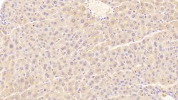 Invitrogen TRAIL-R2 (DR5) Polyclonal Antibody 200 &mu;L; Unconjugated:Antibodies,