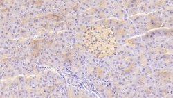 Invitrogen TRAIL-R2 (DR5) Polyclonal Antibody 200 &mu;L; Unconjugated:Antibodies,