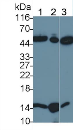 Invitrogen TRAIL-R2 (DR5) Polyclonal Antibody 200 &mu;L; Unconjugated:Antibodies,