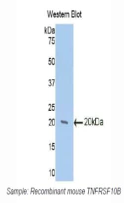 Invitrogen TRAIL-R2 (DR5) Polyclonal Antibody 200 &mu;L; Unconjugated:Antibodies,