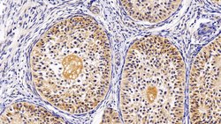 Invitrogen TRAIL-R2 (DR5) Polyclonal Antibody:Antibodies:Primary Antibodies