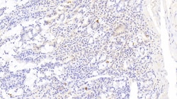 Invitrogen TRAIL-R2 (DR5) Polyclonal Antibody:Antibodies:Primary Antibodies
