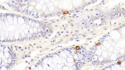 Invitrogen TRAIL-R2 (DR5) Polyclonal Antibody:Antibodies:Primary Antibodies