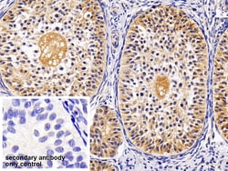 Invitrogen TRAIL-R2 (DR5) Polyclonal Antibody:Antibodies:Primary Antibodies