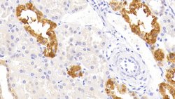 Invitrogen TRAIL-R2 (DR5) Polyclonal Antibody:Antibodies:Primary Antibodies