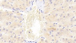 Invitrogen TRAIL-R2 (DR5) Polyclonal Antibody:Antibodies:Primary Antibodies