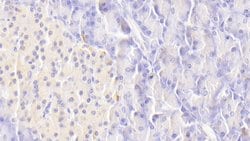 Invitrogen TRAIL-R2 (DR5) Polyclonal Antibody:Antibodies:Primary Antibodies