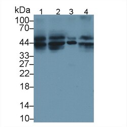 Invitrogen TRAIL-R2 (DR5) Polyclonal Antibody:Antibodies:Primary Antibodies