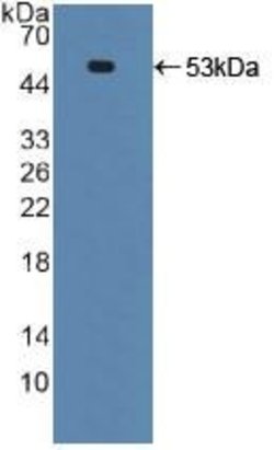 Invitrogen TRAIL-R2 (DR5) Polyclonal Antibody:Antibodies:Primary Antibodies