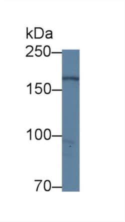 Invitrogen DOCK4 Polyclonal Antibody:Antibodies:Primary Antibodies