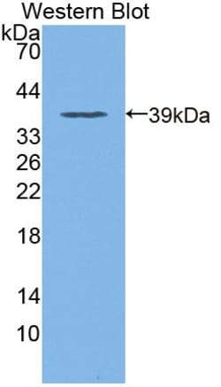 Invitrogen DOCK4 Polyclonal Antibody:Antibodies:Primary Antibodies