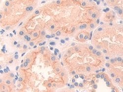 Invitrogen CD148 Polyclonal Antibody:Antibodies:Primary Antibodies