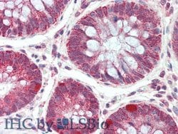 Invitrogen CD148 Polyclonal Antibody:Antibodies:Primary Antibodies