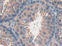 Invitrogen CD148 Polyclonal Antibody:Antibodies:Primary Antibodies