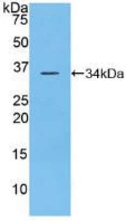 Invitrogen CD148 Polyclonal Antibody:Antibodies:Primary Antibodies