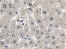 Invitrogen CTBS Polyclonal Antibody:Antibodies:Primary Antibodies