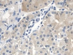 Invitrogen CTBS Polyclonal Antibody:Antibodies:Primary Antibodies