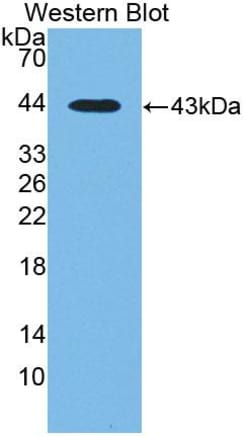 Invitrogen CTBS Polyclonal Antibody:Antibodies:Primary Antibodies