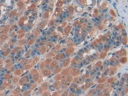 ENPP1 Polyclonal Antibody, Invitrogen 20 &mu;L; Unconjugated:Antibodies,