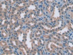 ENPP1 Polyclonal Antibody, Invitrogen 20 &mu;L; Unconjugated:Antibodies,