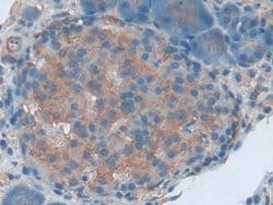 ENPP1 Polyclonal Antibody, Invitrogen 20 &mu;L; Unconjugated:Antibodies,