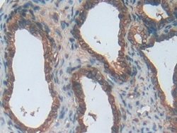 ENPP1 Polyclonal Antibody, Invitrogen 20 &mu;L; Unconjugated:Antibodies,