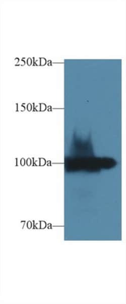 Invitrogen ENPP1 Polyclonal Antibody:Antibodies:Primary Antibodies