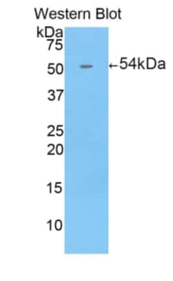 Invitrogen ENPP1 Polyclonal Antibody:Antibodies:Primary Antibodies