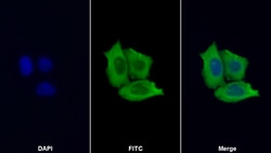 Invitrogen ENO1 Polyclonal Antibody 200 &mu;L; Unconjugated:Antibodies,