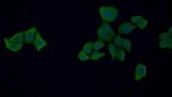Invitrogen ENO1 Polyclonal Antibody 200 &mu;L; Unconjugated:Antibodies,
