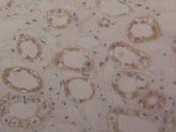 Invitrogen ENO1 Polyclonal Antibody 200 &mu;L; Unconjugated:Antibodies,