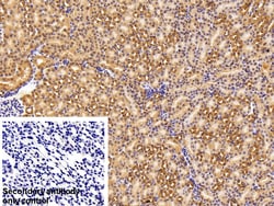 Invitrogen ENO1 Polyclonal Antibody 200 &mu;L; Unconjugated:Antibodies,