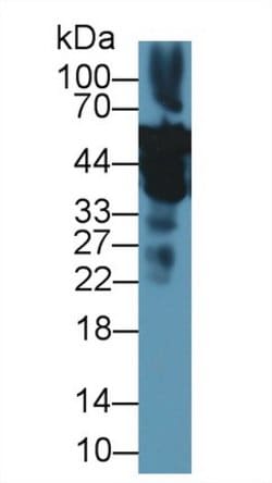 Invitrogen ENO1 Polyclonal Antibody 200 &mu;L; Unconjugated:Antibodies,