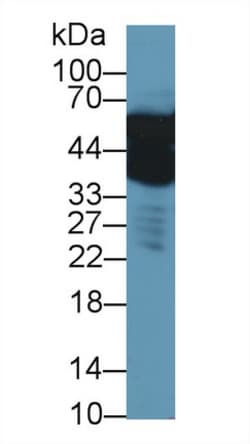 Invitrogen ENO1 Polyclonal Antibody 200 &mu;L; Unconjugated:Antibodies,