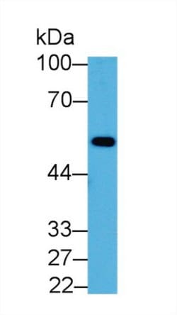 Invitrogen ENO1 Polyclonal Antibody 200 &mu;L; Unconjugated:Antibodies,