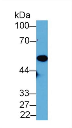 Invitrogen ENO1 Polyclonal Antibody 200 &mu;L; Unconjugated:Antibodies,