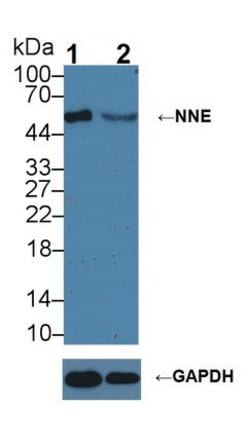 Invitrogen ENO1 Polyclonal Antibody 200 &mu;L; Unconjugated:Antibodies,
