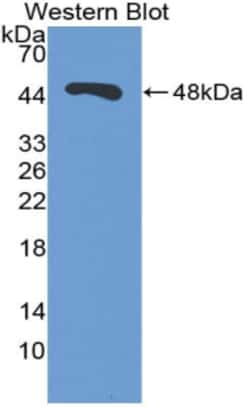 Invitrogen ENO1 Polyclonal Antibody 200 &mu;L; Unconjugated:Antibodies,