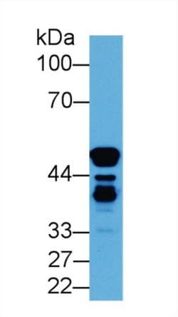 Invitrogen ENO1 Polyclonal Antibody 200 &mu;L; Unconjugated:Antibodies,