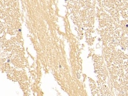 Invitrogen NSE Polyclonal Antibody:Antibodies:Primary Antibodies