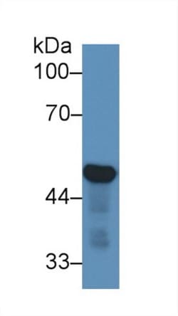 Invitrogen NSE Polyclonal Antibody:Antibodies:Primary Antibodies