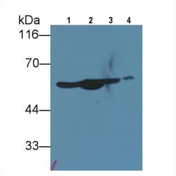 Invitrogen NSE Polyclonal Antibody:Antibodies:Primary Antibodies
