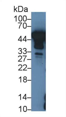 Invitrogen NSE Polyclonal Antibody:Antibodies:Primary Antibodies
