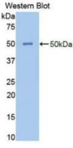 Invitrogen NSE Polyclonal Antibody:Antibodies:Primary Antibodies