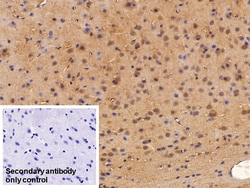 Invitrogen NSE Polyclonal Antibody 200 &mu;L; Unconjugated:Antibodies,